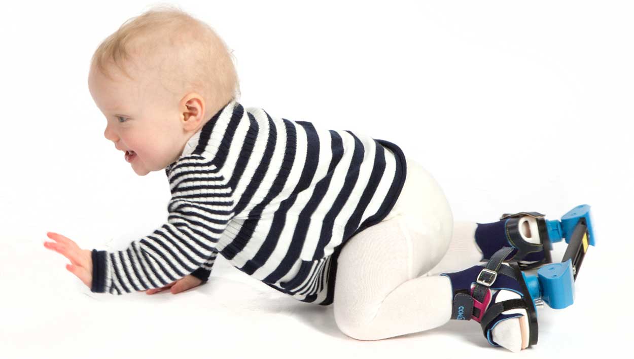 קלאב פוט תינוק זוחל